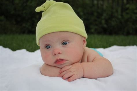 What to say to the parents of a baby with down syndrome: FAQ and Facts about Down Syndrome - Global Down Syndrome ...
