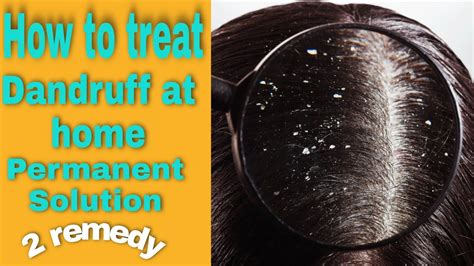 Dandruff Treatment At Home How To Get Rid Of Dandruff Winter Hair