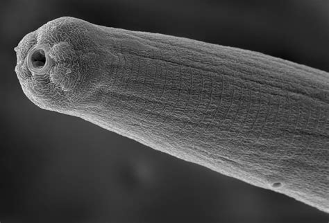 Nematode Worms In Humans