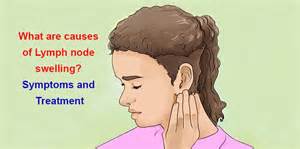 What Are Causes Of Lymph Node Swelling Symptoms And Treatment