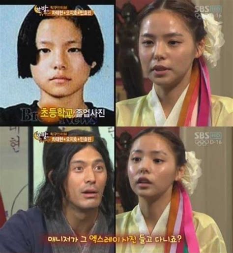Min Hyo Rin Fesses Up On Receiving Cosmetic Surgery