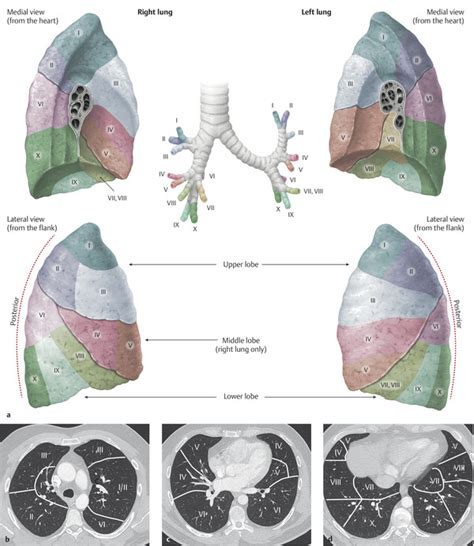 Lung And Pleura Radiology Key