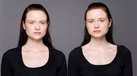 11 different types of twins that really exist in the world