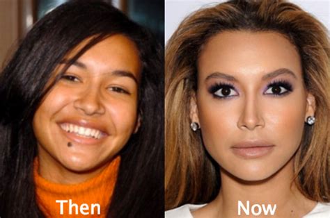 Naya Rivera Plastic Surgery Before And After Photos