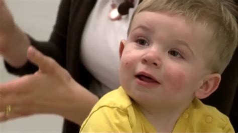 Toddler Learns To Walk With New Prosthetic Leg Doctors Say Hell Be