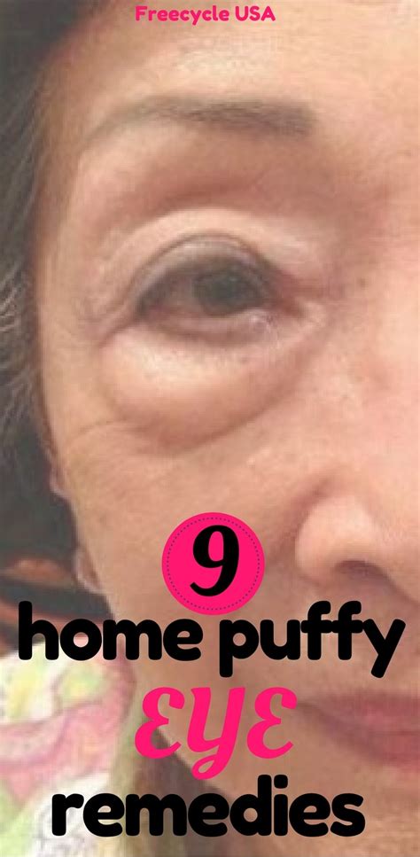 This cosmetic problem is rarely a sign of a more serious disease, but before it is proceeded to treatment, any medical issue should be ruled out. 9 Home Puffy Eye Remedies - FREECYCLE USA