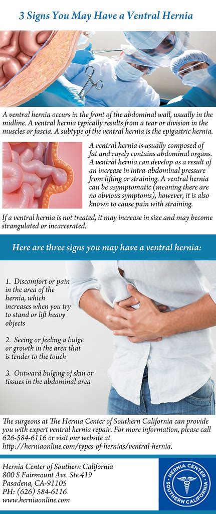 3 Signs You May Have A Ventral Hernia A Ventral Hernia Occ Flickr