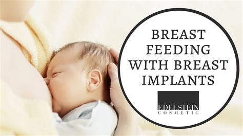 Breastfeeding With Breast Implants Edelstein Cosmetic Youtube