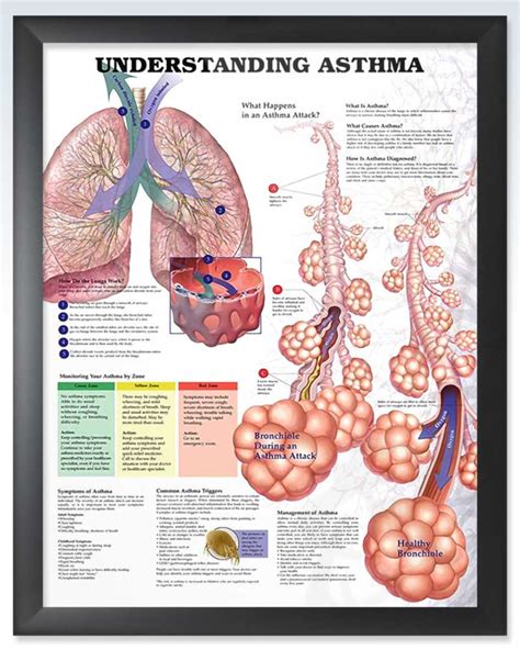 Asthma Exam Room Human Anatomy Posters Clinicalposters