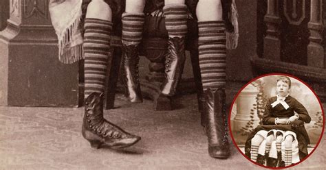 This Girl Was Deemed A Monster For Having Four Legs The Vintage News