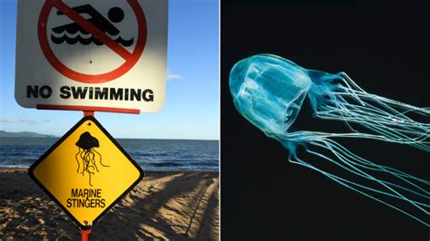 Box Jellyfish New Antidote Trial For One Of Australias