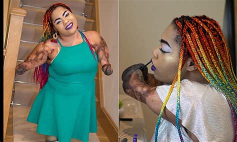 Quadruple Amputee Reveals How Beauty Helped Boost Her Confidence