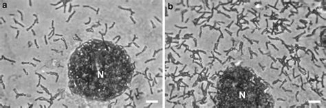 Study Of The Adhesion Of Bifidobacterium Bifidum Mimbb75 To Human