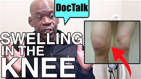 SWELLING IN THE KNEE Why You Get It How To Treat It With Orthopedic