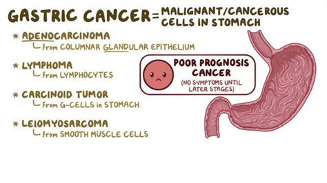 Stomach Cancer Gastric Cancer Purwanchal Cancer Hospital