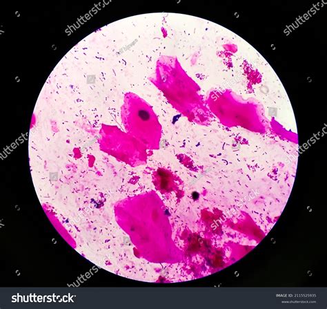 Sputum Smear Gram Stained Microscopic 100x Stock Photo 2115525935