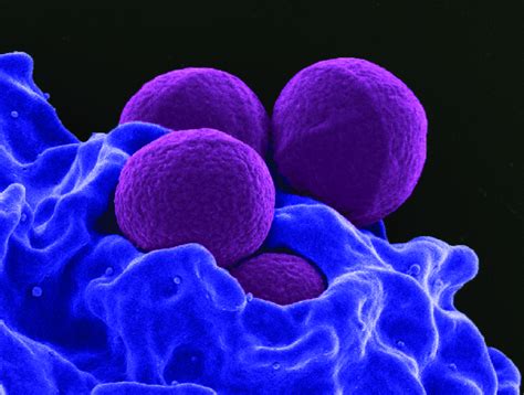 Methicillin Resistant Staphylococcus Aureus Mrsa Scanning Electron