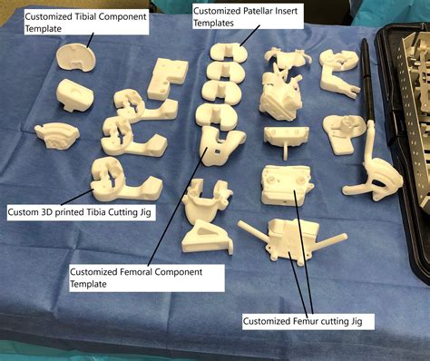 Knee Arthroplasty Implants Complete Orthopedics Multiple Ny Locations