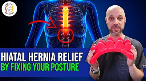 Learn How To Fix Your Hiatal Hernia By Fixing Your Posture Youtube