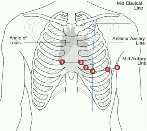 24 Best Cardiac Images On Pinterest Nursing Schools Schools For