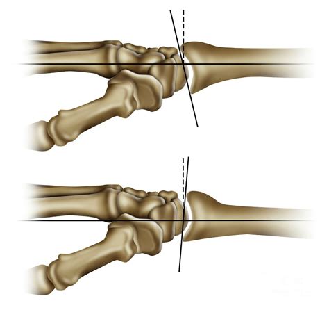 Wrist Joint Movements By Maurizio De Angelisscience Photo Library