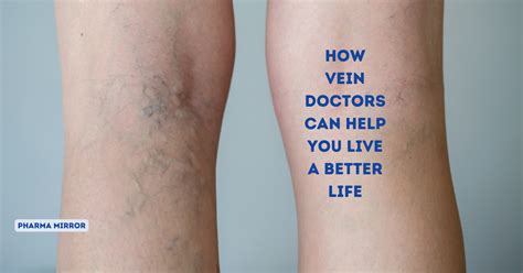 How Vein Doctors Can Help You Live A Better Life Pharma Mirror Magazine
