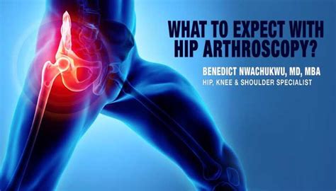 What To Expect With Hip Arthroscopy Manhattan New York City Ny
