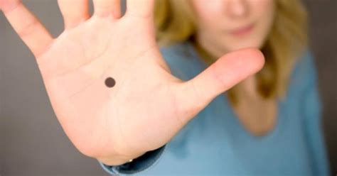 Spot A Black Dot On Someones Palm Dont Ignore It Hurry And Call The