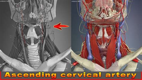 Inflammation appears to play a role in the development of the syndrome—biopsy specimens of patients with this condition have been shown to have cells known as lymphocytes, which indicate chronic inflammation. Ascending cervical artery | Arteries of head and neck | 3D Human Anatomy | Organs - YouTube
