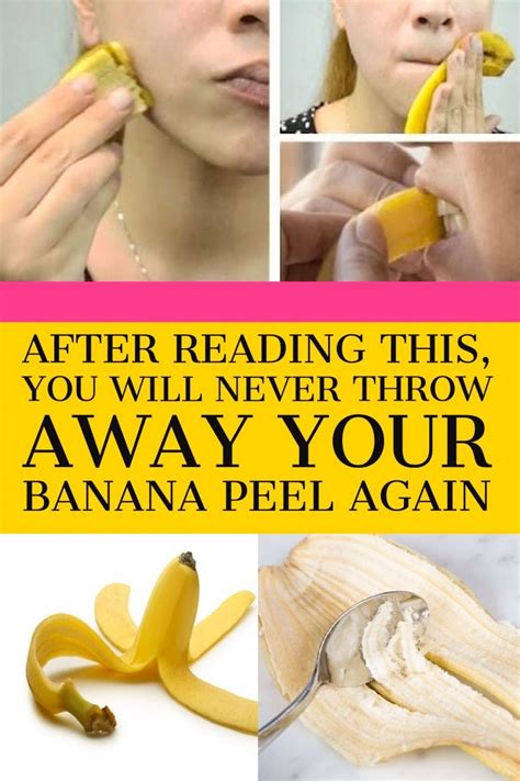 Use Banana Peel For Treating Acne With These 5 Simple Steps Video