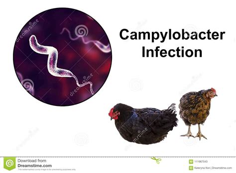 Chicken As The Source Of Campylobacter Infection Stock Image Image Of