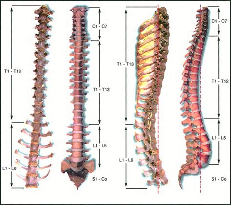 Anatomy Of Deer Spine And Its Comparison To The Human Spine Kumar