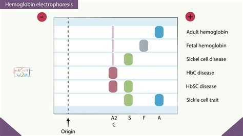 Hemoglobin Electrophoresis YouTube