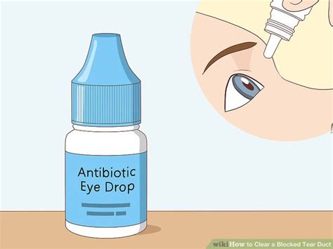 How To Clear A Blocked Tear Duct 12 Steps With Pictures