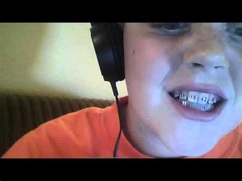 Having A Loose Bracket With Braces Youtube