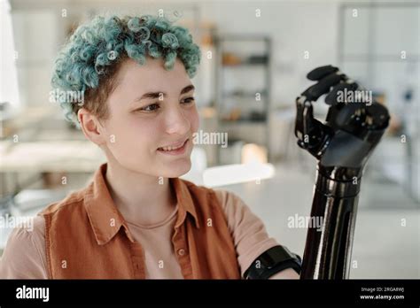 Woman Amputee Arm Hi Res Stock Photography And Images Alamy