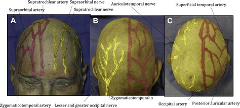 Reconstruction Of The Scalp Calvarium And Frontal Sinus Oral And