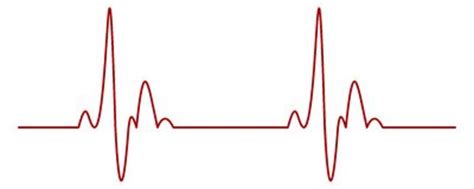 Giphy is how you search, share, discover, and create gifs. Herzschlag Stock Illustrationen, Vektors, & Klipart ...