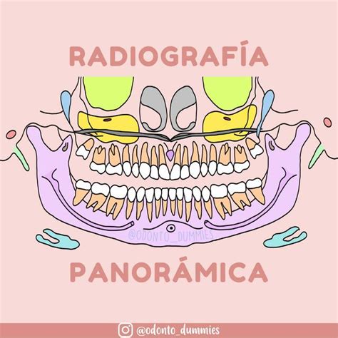 Partes De La Radiografía Panorámica Odonto Dummies Udocz