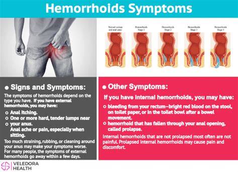 hemorrhoids causes symptoms and treatment