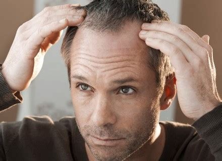 Best Hair Loss Treatments For Men That Actually Work