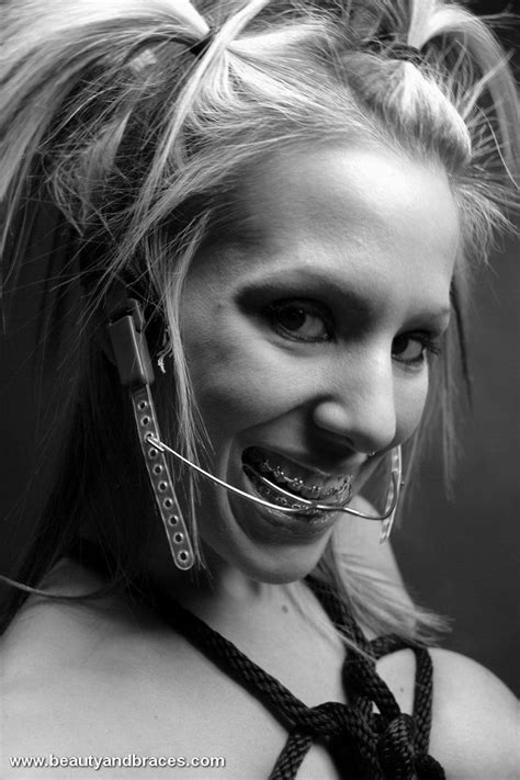 Pin By Kevin Kelly On Headgear Dental Braces Teeth Braces Braces Girls