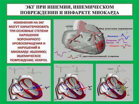 Диета при ишемии миокарда Атеросклероз и его проявления - презентация онлайн Атеросклероз и его проявления - презентация онлайн Диета при ишемии миокарда