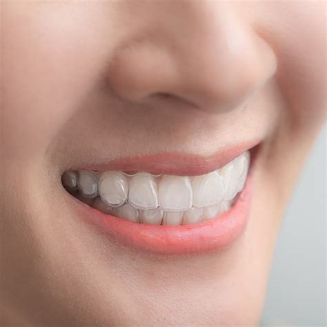 Invisalign® Clear Braces Weber Dental Center Spokane Valley Wa