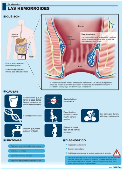 Hemorroides Sufrirlas En Silencio Pero No En Secreto Salud Ediciones