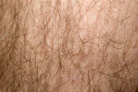 Male Leg Hair Stock Image C0226700 Science Photo Library