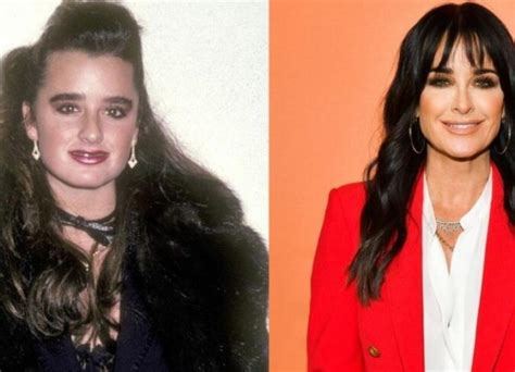 kyle richards weight loss 2023 what weight loss did the reality star experience