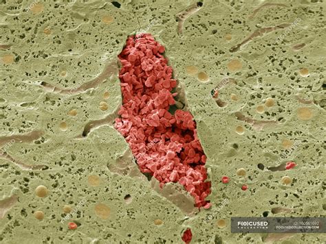 Coloured Scanning Electron Micrograph Sem Of A Section Through A Vein