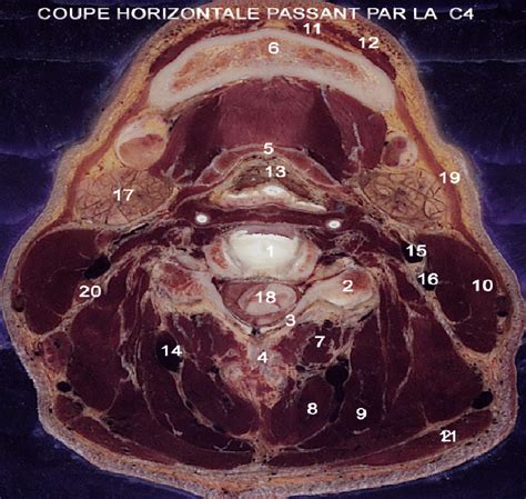 Anatomical Section Through The Fourth Cervical Vertebra C4 1
