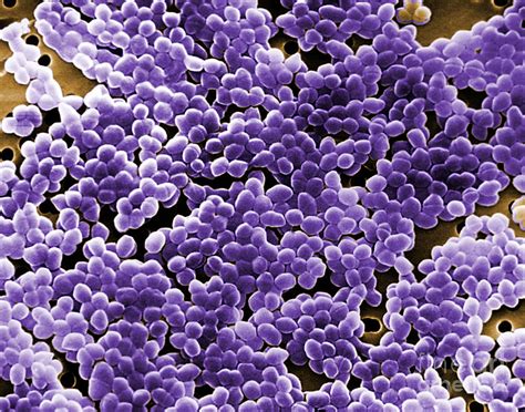 Enterococcus Sp Bacteria Sem Photograph By Science Source Pixels